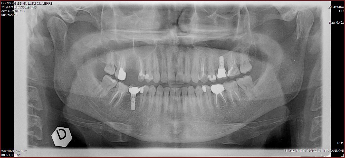 panoramica-dentale-08-06-13.jpg