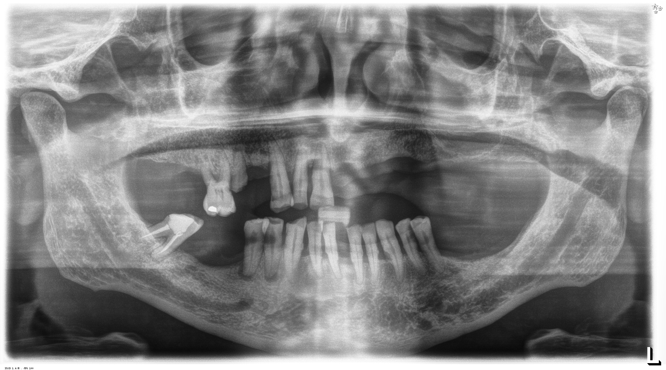 panoramica-dentale-claudio--opt.jpg