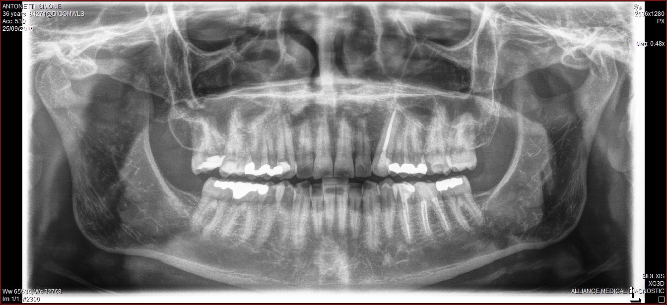 panoramica-denti-simo.jpg