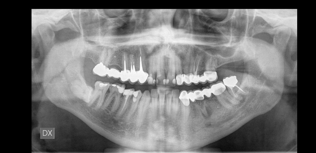 SEGUITO ALLA DOMANDA: Mi ritrovo un granuloma da circa 7 anni