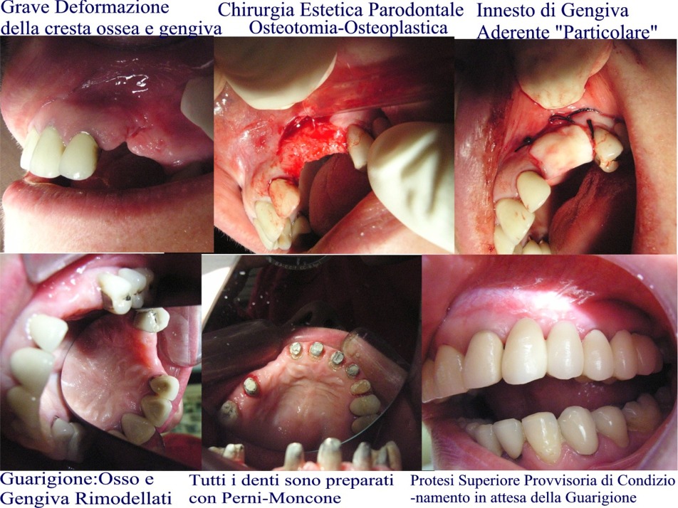 parodontologia-ricostruzione-sella17.jpg