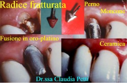 pernomoncone--dr.gustavo-petti-cagliari-201115.jpg