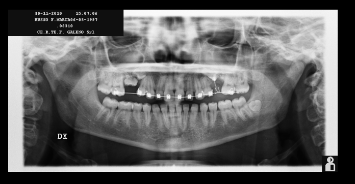 radiografia.png
