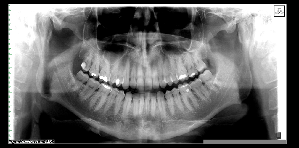 radiografia001.jpg