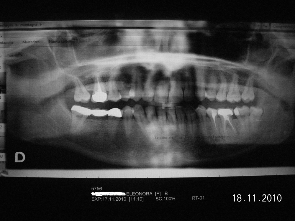 Soffro tantissimo per un dolore ai denti di cui non si riesce a individuare la causa.