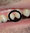 Da circa tre mesi ho notato che tra i due denti ho un colore più scuro