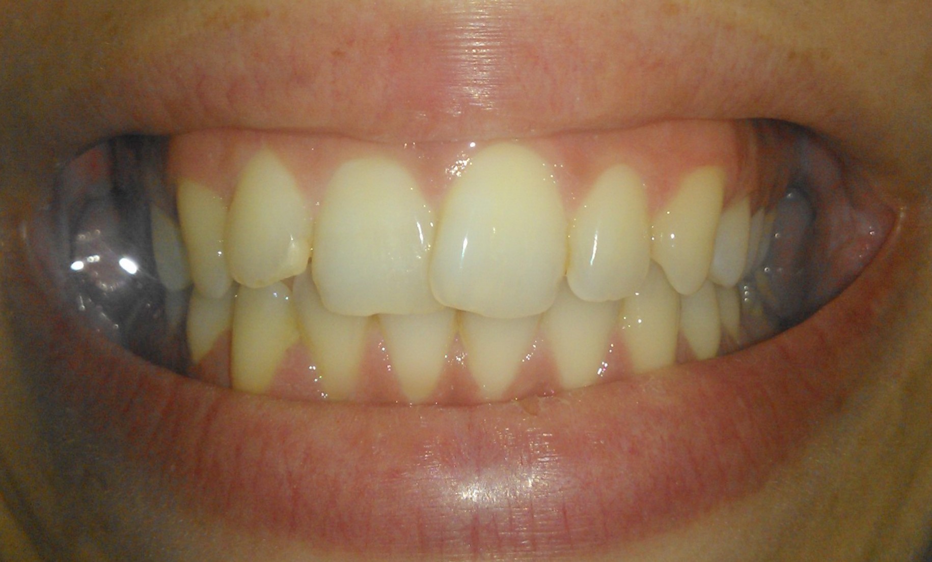 si1dentidavanti.jpg