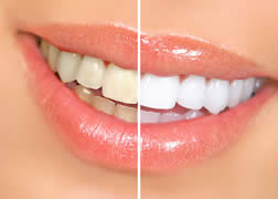 Studio Dentistico Gattuso