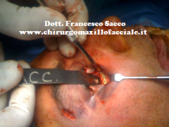 Dott. Francesco Sacco