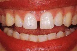 Estetica dei denti e del sorriso
