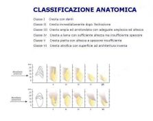 Tecnica Chirurgica e Protesica per Riabilitazione con Minimpianti in cresta atrofica mandibolare posteriore