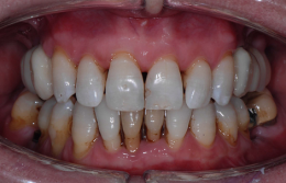 Igiene dentale