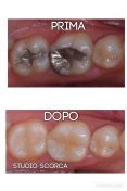Ricostruzione estetica denti