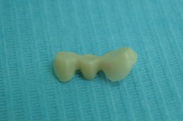 Ponte in zirconia