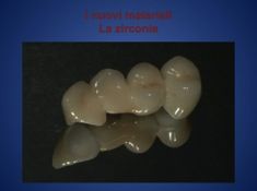 La zirconia-ceramica