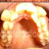 Caso Clinico Ortodontico