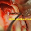 Piezosurgery removal of cysts and apicoectomy