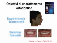 Masticazione e Ortodonzia