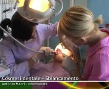 Cosmesi dentale Sbiancamento