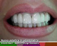 Nuova estetica in odontoiatria