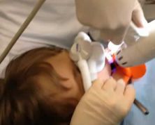 Protossio d'azoto e cura in bambino con paura del dentista