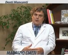 Denti mancanti